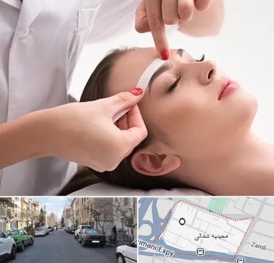 اپیلاسیون در مجیدیه شمالی