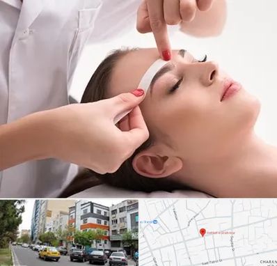 اپیلاسیون در هفده شهریور تبریز