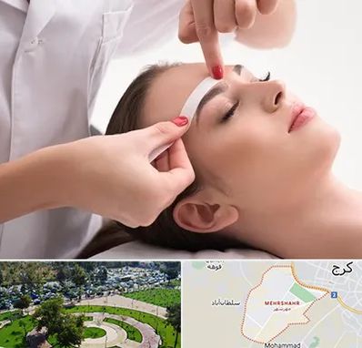 اپیلاسیون در مهرشهر کرج 