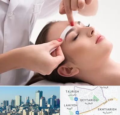 اپیلاسیون در قیطریه 