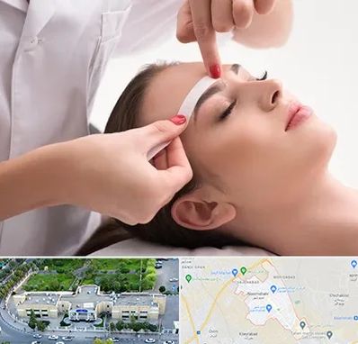 اپیلاسیون در نسیم شهر