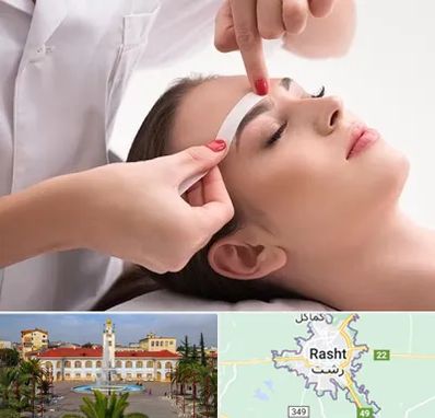 اپیلاسیون در رشت