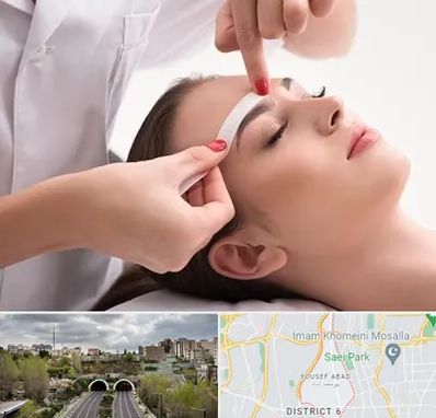 اپیلاسیون در یوسف آباد 