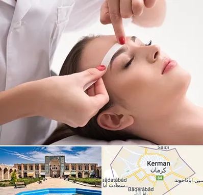 اپیلاسیون در کرمان