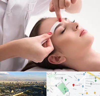 اپیلاسیون در هنگام