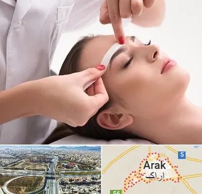 اپیلاسیون در اراک