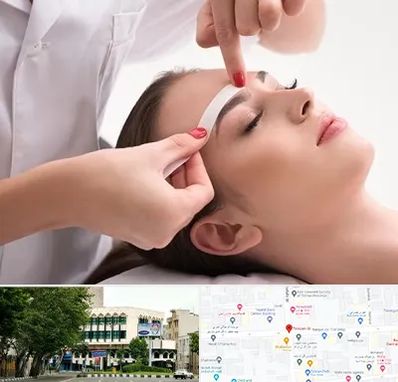 اپیلاسیون در طالقانی