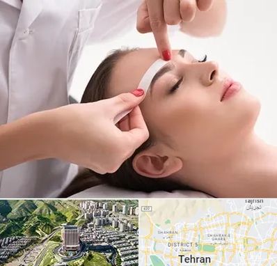 اپیلاسیون در شمال تهران 