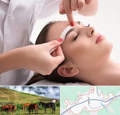 اپیلاسیون در تالش