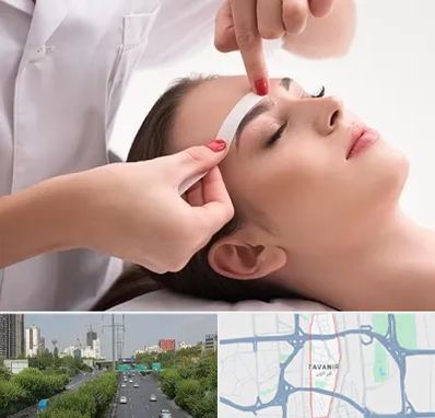 اپیلاسیون در توانیر