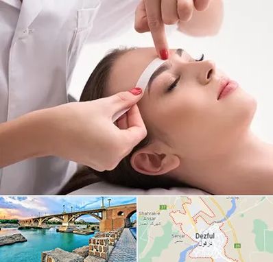 اپیلاسیون در دزفول