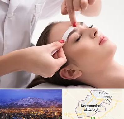 اپیلاسیون در کرمانشاه