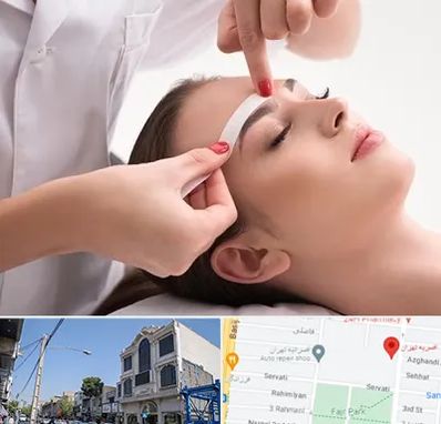 اپیلاسیون در افسریه 