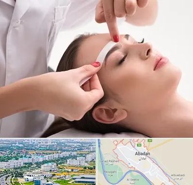 اپیلاسیون در آبادان