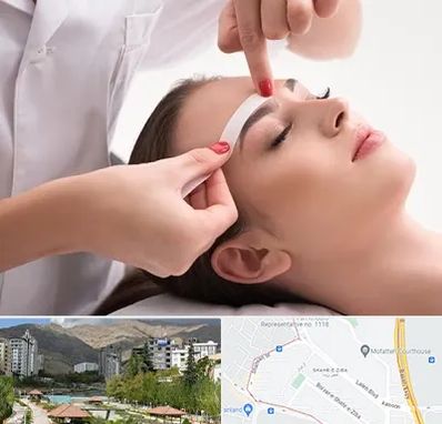 اپیلاسیون در شهر زیبا