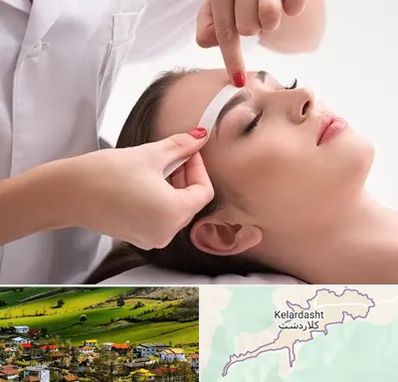 اپیلاسیون در کلاردشت