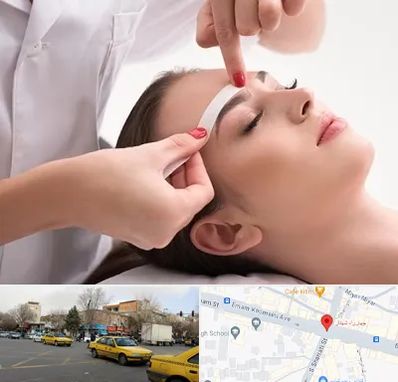 اپیلاسیون در شهناز تبریز