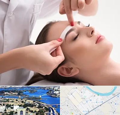 اپیلاسیون در کوروش اهواز