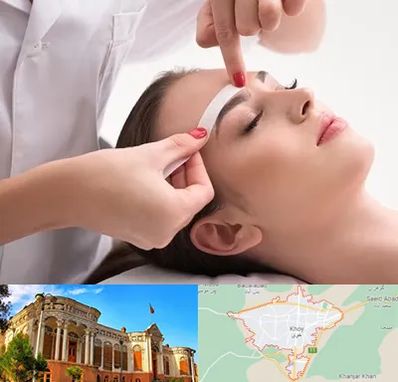 اپیلاسیون در خوی