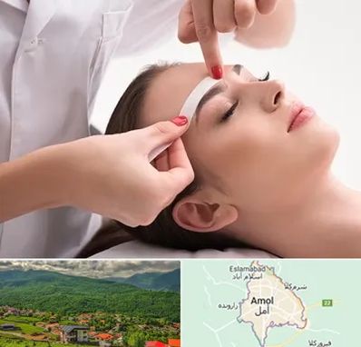 اپیلاسیون در آمل