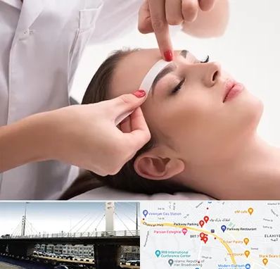 اپیلاسیون در پارک وی 