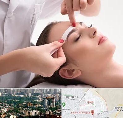 اپیلاسیون در عظیمیه کرج 