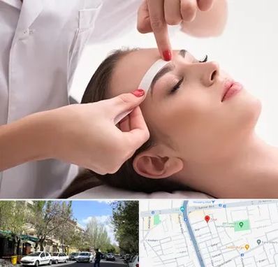 اپیلاسیون در کوی فیروز تبریز