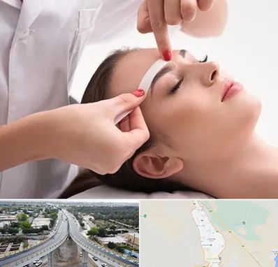 اپیلاسیون در اندیمشک