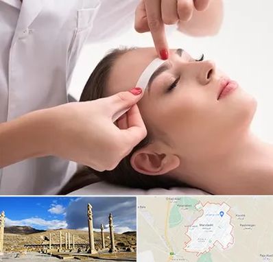 اپیلاسیون در مرودشت