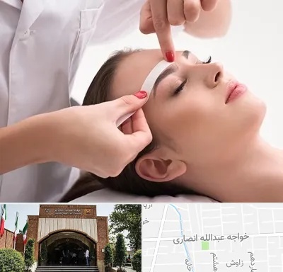 اپیلاسیون در خواجه عبدالله