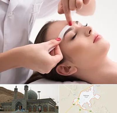 اپیلاسیون در شهرضا