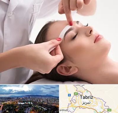 اپیلاسیون در تبریز