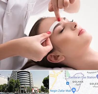 اپیلاسیون در قلهک 