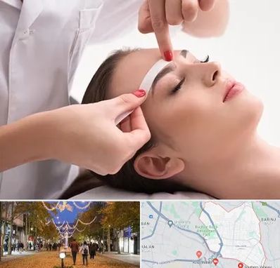 اپیلاسیون در ولیعصر ارومیه