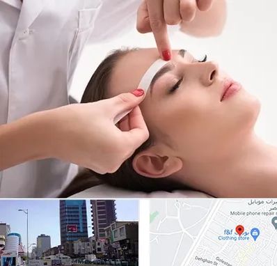 اپیلاسیون در چهارراه طالقانی کرج