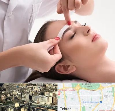 اپیلاسیون در مرزداران 