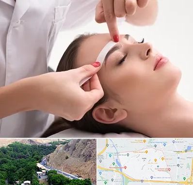 اپیلاسیون در کن