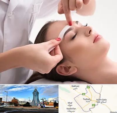 اپیلاسیون در تایباد