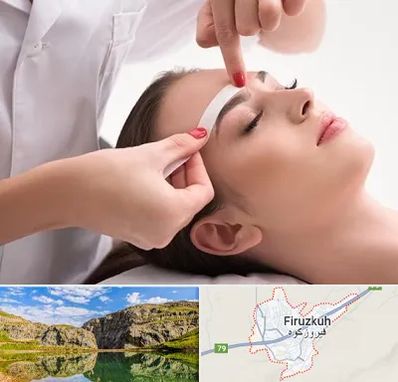 اپیلاسیون در فیروزکوه