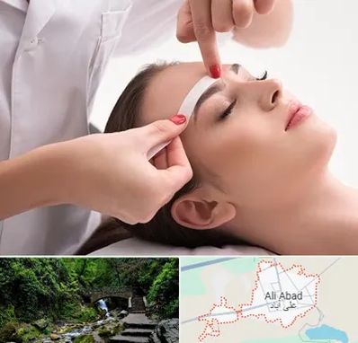 اپیلاسیون در علی آباد کتول