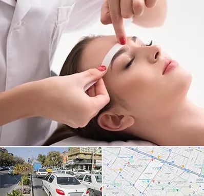 اپیلاسیون در مفتح مشهد