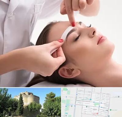 اپیلاسیون در مرداویج اصفهان