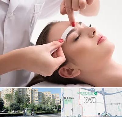 اپیلاسیون در آپادانا