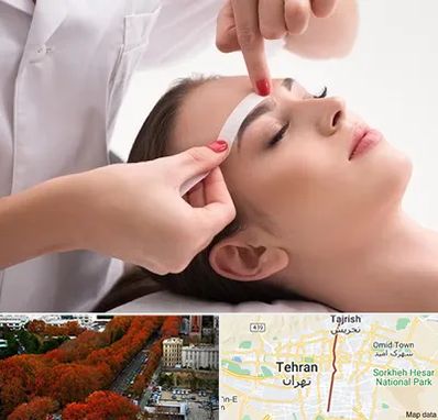 اپیلاسیون در ولیعصر 