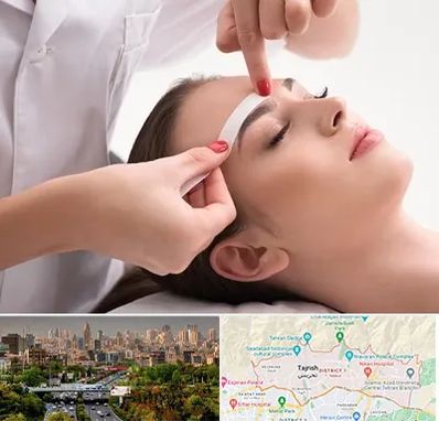 اپیلاسیون در منطقه 1 تهران