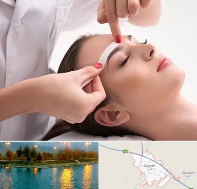 اپیلاسیون در قروه