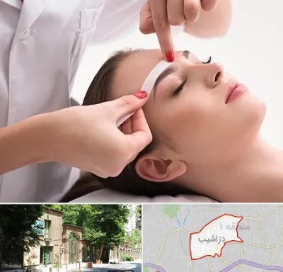 اپیلاسیون در دزاشیب