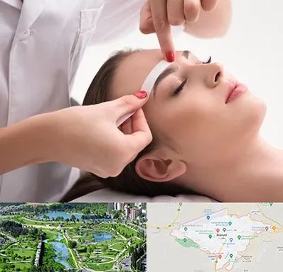 اپیلاسیون در بجنورد