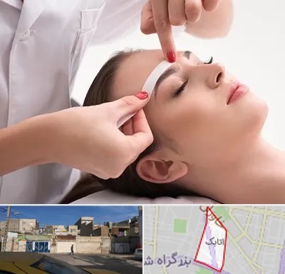 اپیلاسیون در اتابک