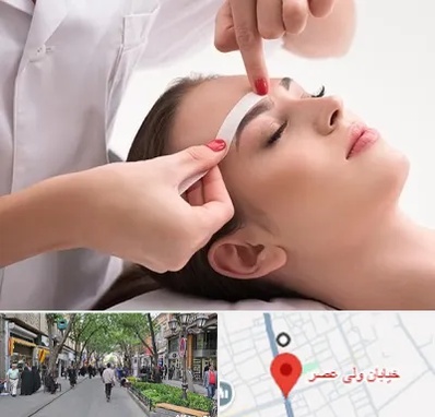 اپیلاسیون در ولیعصر شهریار